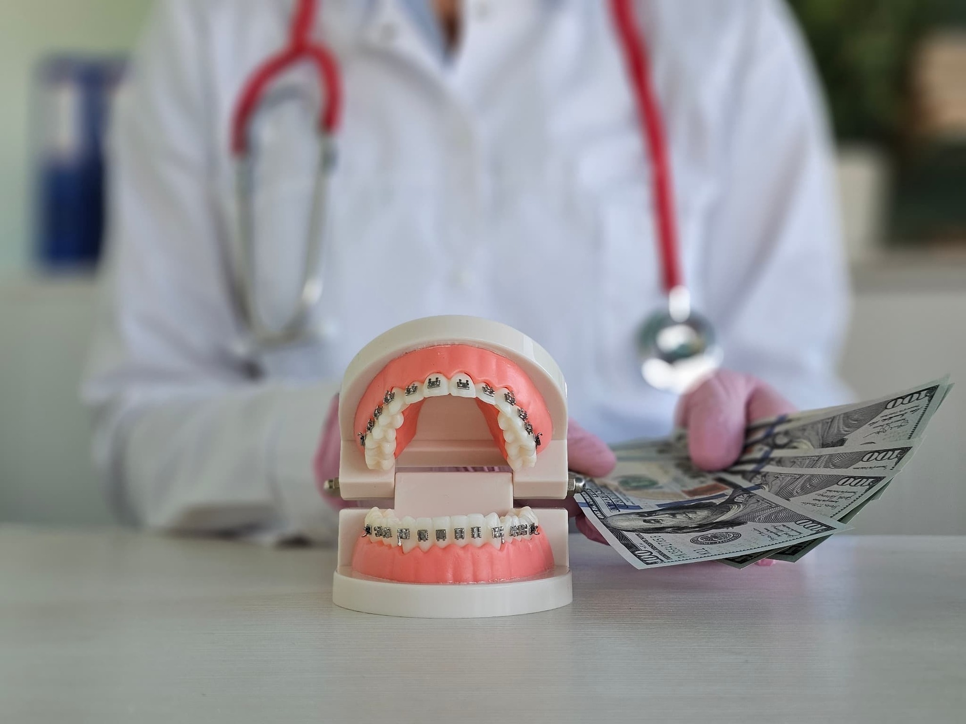 ワイヤー矯正にかかる費用のイメージ