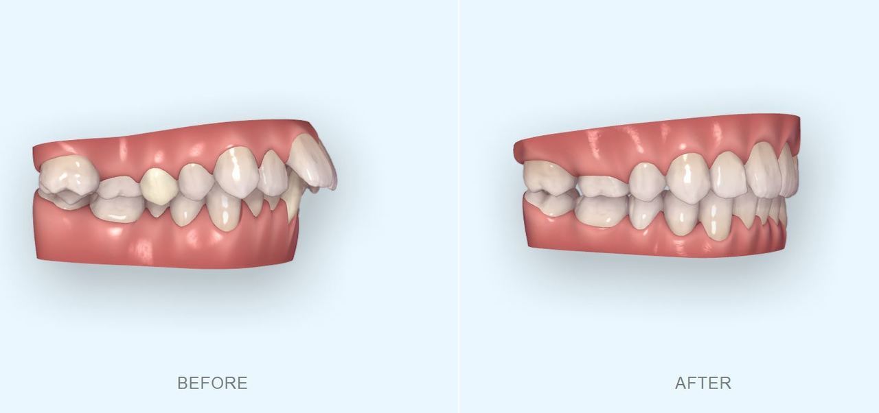 こだわったつめもの・かぶせ物