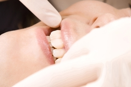 酒々井町の親知らずの抜歯・治療