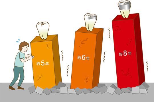 成田市・酒々井の虫歯治療・銀歯を繰り返している方へ