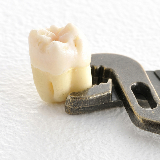 酒々井町の親知らずの抜歯・治療