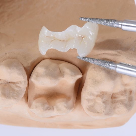 成田市・酒々井のセラミック治療