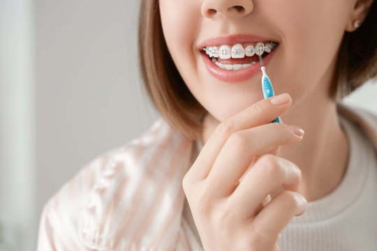 ワイヤー矯正中に丁寧に口腔ケアをする女性