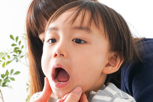 成田市・酒々井のマイオブレース（筋機能矯正装置）について