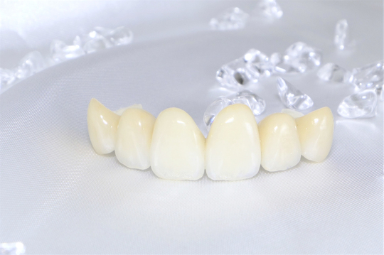 成田市・酒々井の虫歯治療・銀歯を繰り返している方へ