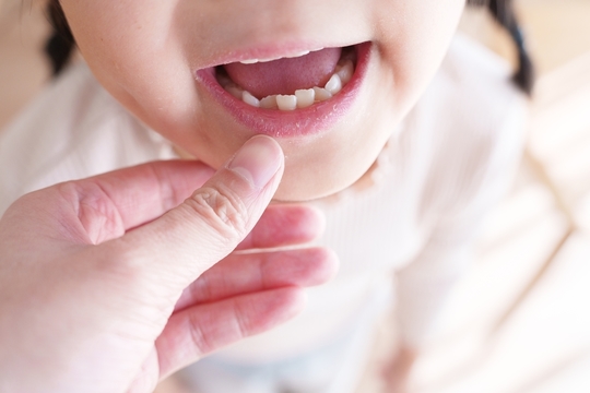 成田市・酒々井の小児（子供）の外傷