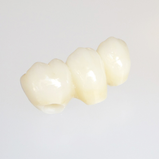 成田市・酒々井のセラミック治療