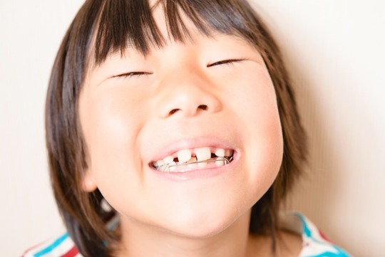 すきっ歯で笑う女の子