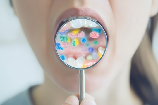 すきっ歯を放置して口腔内の環境が悪化した様子