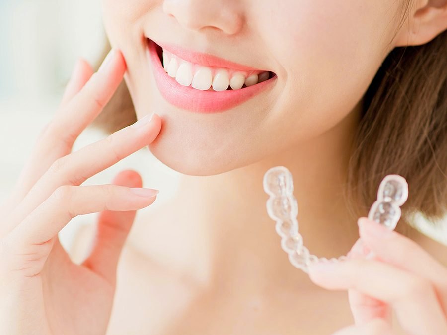 口元に手を添えて笑う女性と、透明なマウスピース